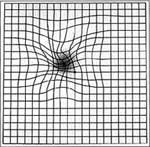 amsler grid