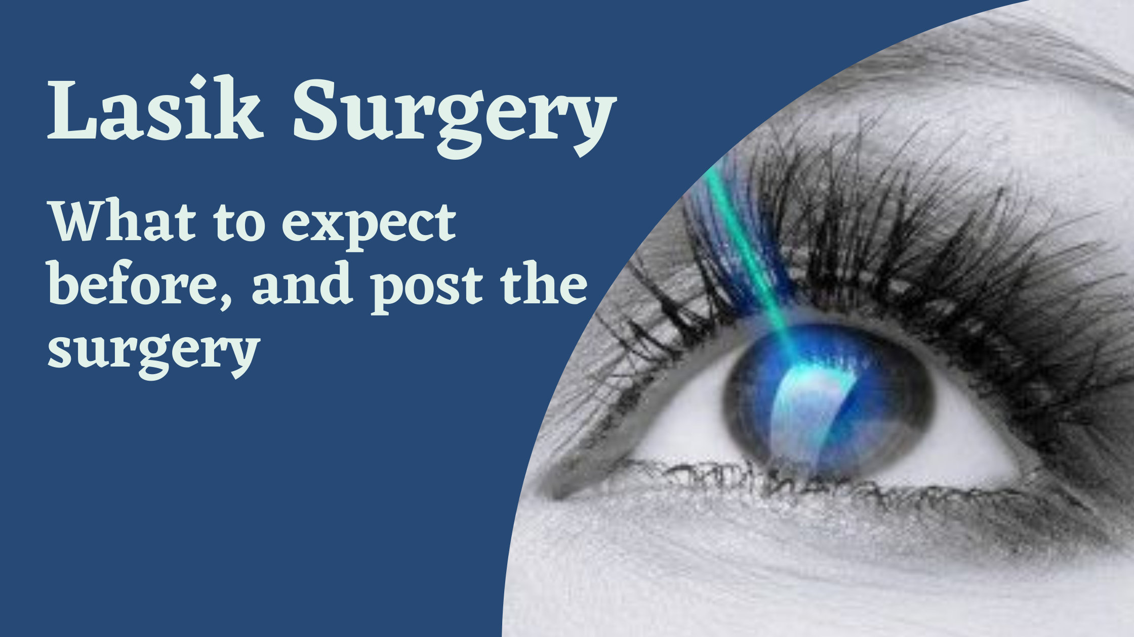 Lasik Surgery: What to expect before, and post the surgery