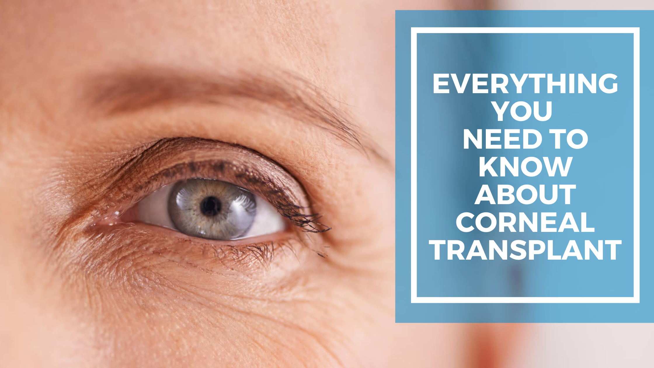 Everything you Need to know About Corneal Transplant