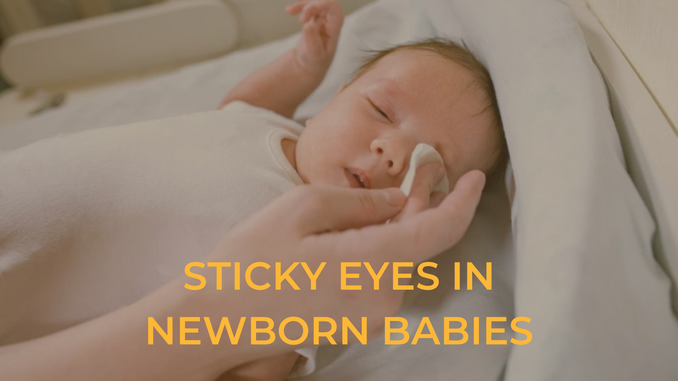 Sticky Eyes in Newborn Babies