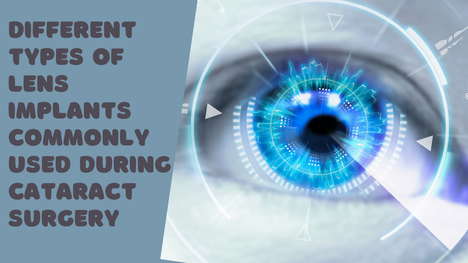 Different Types Of Lens Implants Commonly Used During Cataract Surgery 