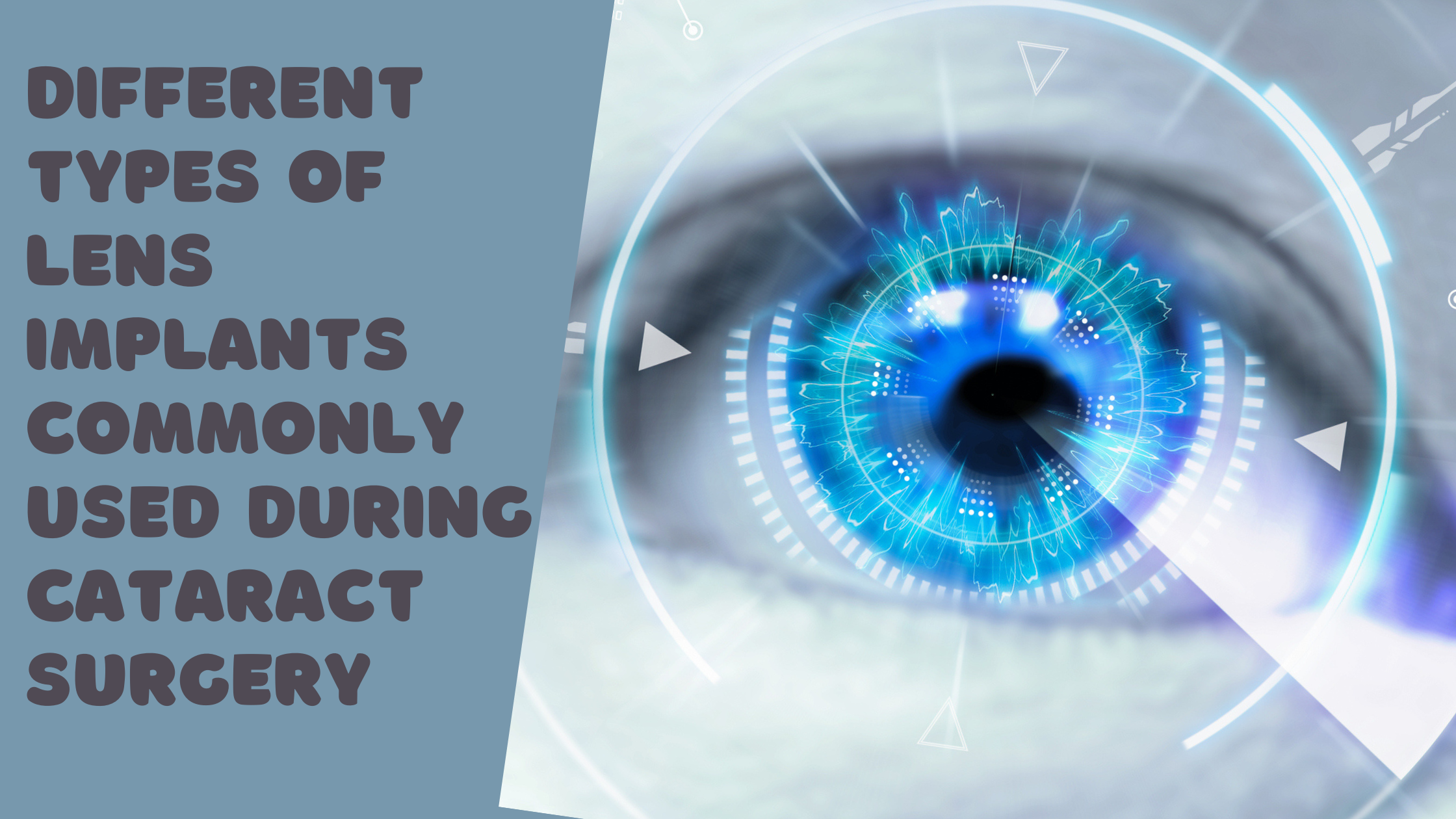 Different types of lens implants commonly used during cataract surgery