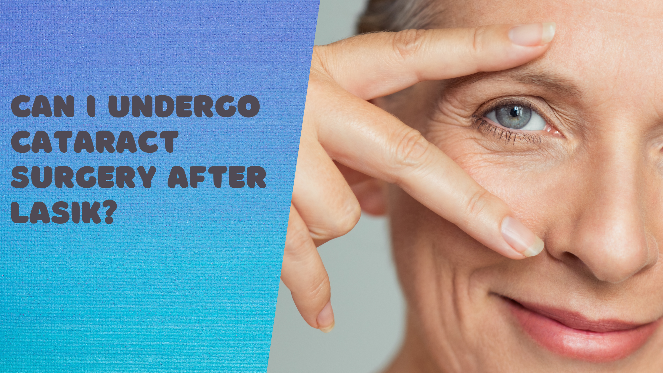 Can-I-Undergo-Cataract-Surgery-After-LASIK