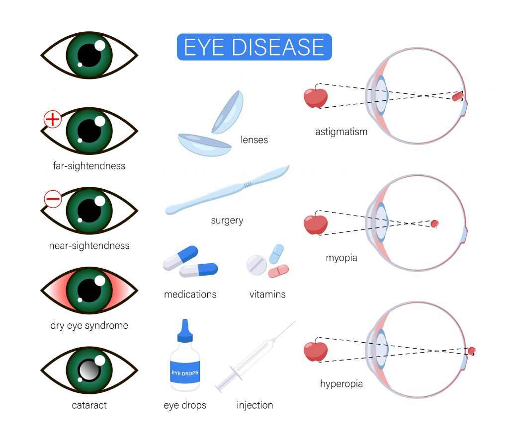 eye diseases or disorder cartoon illustration set 1