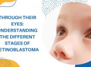 stages of retinoblastoma