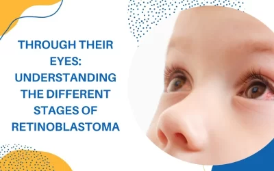 Through Their Eyes: Understanding the Different Stages of Retinoblastoma