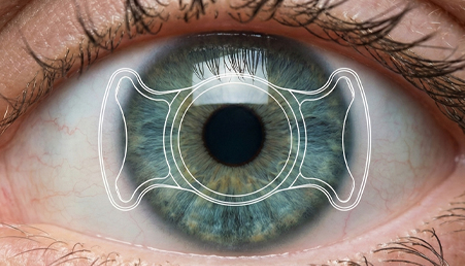 ICLSurgery