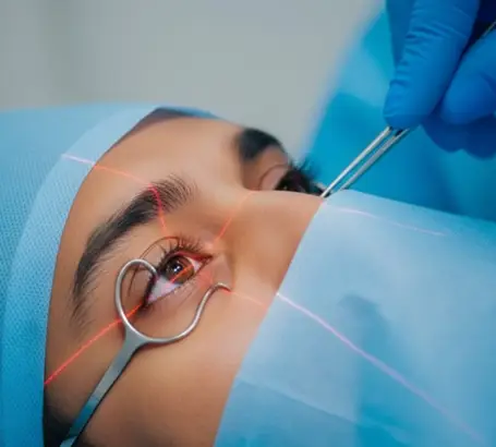 PTK (Phototherapeutic Keratectomy)